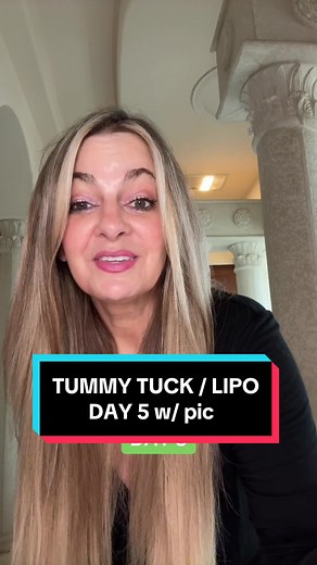 Tummy Tuck and Liposuction Recovery: Day 5 Journey and Tips