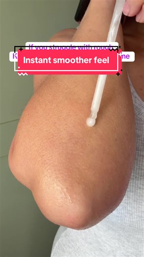 Transform Your KP-Prone Elbows with This Exfoliation Routine