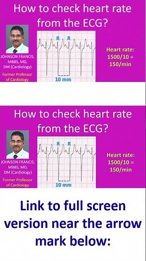 How to check heart rate from the ECG?