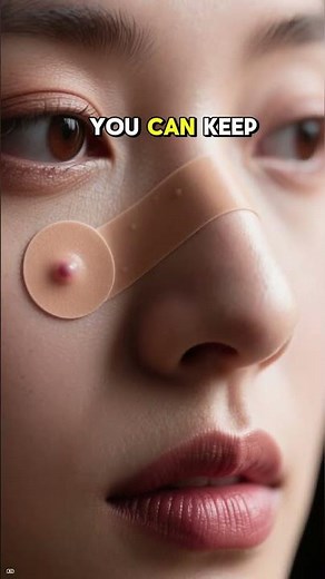 PIMPLE PATCHES for FACE Explained Simply By AI ✨ What Are Benefits? Do They Actually Work for Zits?