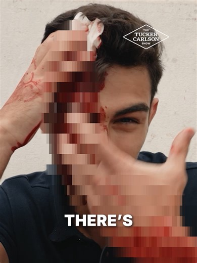 Anthony and Josh Rubin were attacked while documenting the illegal mass migration of the West. This is a shocking story. Watch our new documentary Replacing Europe only on TuckerCarlson.com.