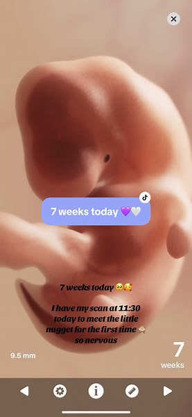 Fetal Development at 7 Weeks: Anticipation and Growth