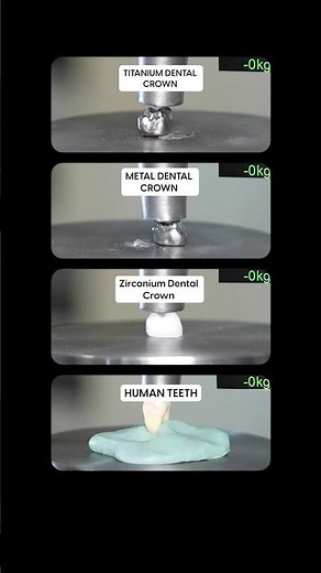 Strongest Dental Crown Material? #durabilitytest