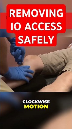 Removal of intraosseous (IO) needle