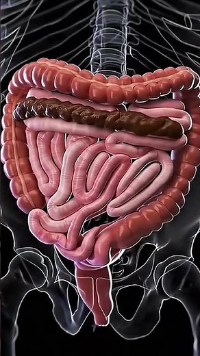 3D Animation of Constipation Explained | Gut Health