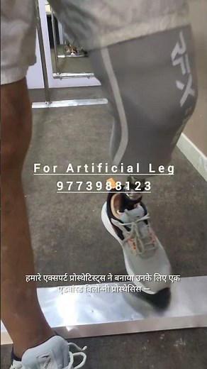 Ossur Below-knee Prosthesis | Proflex XC Prosthetic Foot | Gel Liner