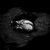 Video: Assessment of Cardiac Function and Myocardial Morphology Using Small Animal Look-locker Inversion Recovery SALLI MRI in Rats