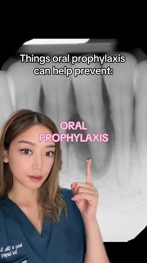 Importance of Dental Cleaning for Preventive Care