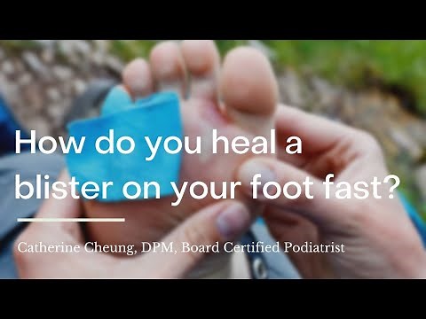 How do you heal a blister on your foot fast?