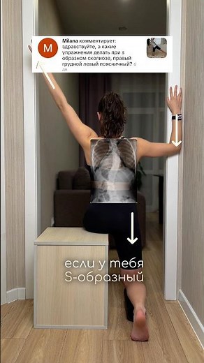 Упражнения для S образного сколиоза #сколиоз #коррекциясколиоза