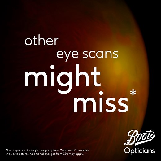 21M views · 51 reactions | Unlock more about your eye health with our Ultimate Eye Test  | Boots Opticians | Facebook