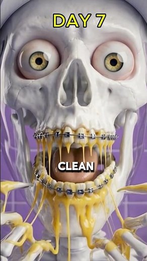 What REALLY Happens to Your Mouth When You Get Braces 😬🦷