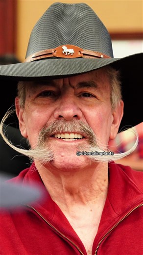 PART 1 🎥🦷 Patient from Arizona 📍 Veteran & professional poker player gets a brand new smile 😎♠️ All-On-4 Dental Implants Zirconia set delivered the day after surgery. Ever wonder why teeth look so white in videos? 👀 Office lighting cameras make them look brighter! they look different in real life. Stay tuned for Part 2 👀🔥 follow us on instagram for part 2 #newsmile #arizonacheck #dentures #dentalimplants #allon4