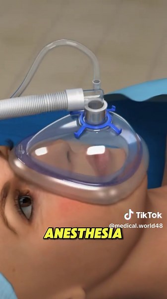 Distal Radius Fracture Surgery Explained in 30 Seconds