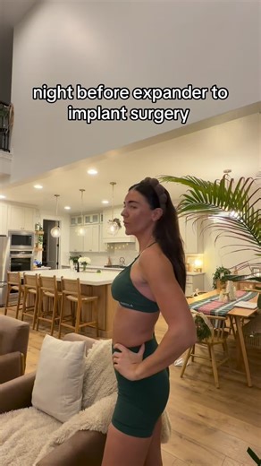 Melanie DeVore on Instagram: "6 weeks post op expander to implant surgery with lipo + fat grafting! Time has felt so slow and so fast at the same time! Feels so good to be officially done 🎉 #doublemastectomy #breastcancerawareness #mastectomy #womenshealthmatters #pov"