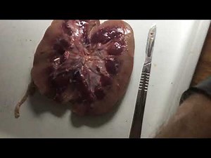 Fresh Pig Kidney Dissection