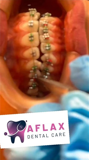 ‏#AFLAX DENTAL CARE