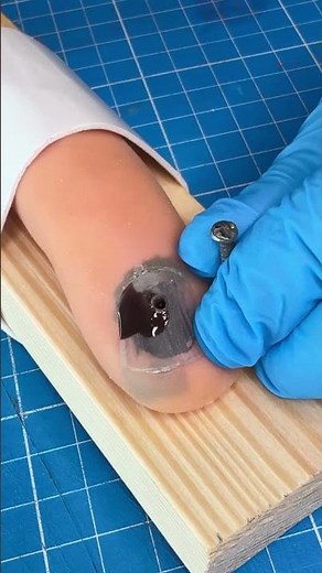 This needle trick removes nail blood instantly #drainage #oddlysatisfying
