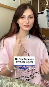 No one believes my scar is real 😱🫀#hearttransplant #medicalstorytime #surgeryscar #heartfailure