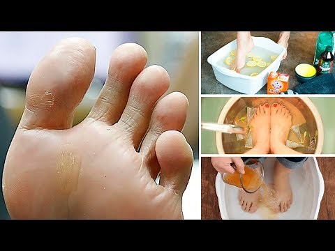 How to Get Rid of Smelly Feet for Good!
