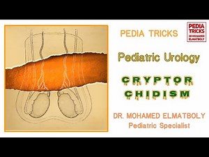 Undescended testes - Life & Exam Tricks
