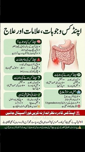 What Is Appendix? Causes, Symptoms & Treatment