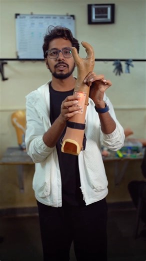 Prashant Gade | 15,000+ people have received free prosthetic hands from Inali Foundation, gaining back not just their limbs but their dignity. Each hand... | Instagram