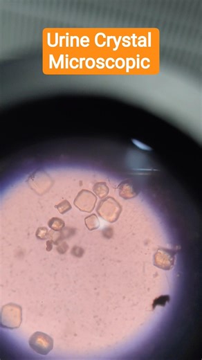 Urine Microscopic Examination #lablife #labtech #labtechnician #dmlt