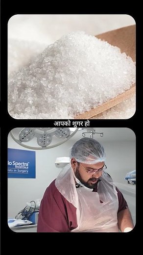 Phimosis की ZSR Surgery | Dr. Gupta Shows the Full Procedure