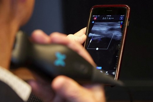 Ultrasound app allows doctors to diagnose cancer earlier