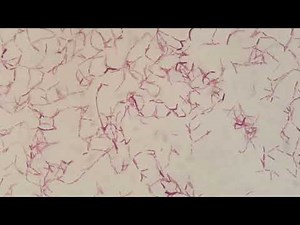 Modified Acid-Fast Staining of Nocardia: Diagnostic Techniques and Clinical Significance