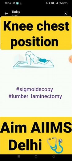 knee chest position #viral #mbbs #neet #nursing #aiims #shotrs #aim #medical #aiimsdelhi 🩺🩺🩺🩺🩺🩺