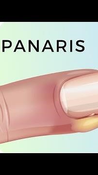 comment soigner les panaris naturellement #panaris #astuce