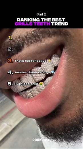 The diamond density is pure insanity! 🤯 Ranking the best grills teeth trend part 6 #grills #ice