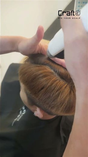 12. How to use Scalp Clinic Booster Dose DSA