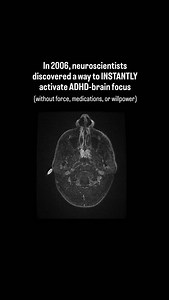 Most people think ADHD focus kicks in randomly… but a 2006 neuroscience study found something different: 🧠 ADHD brains switch into “task mode” when two signals appear at the same time: movement a single clear target. That’s why you can scroll forever but freeze on important tasks. Scrolling gives your brain both signals (constant micro-movement one thing to focus on). Real tasks do not. But here’s the part researchers found that changed everything: ⭐ The “10-Minute Activation Window” When you c