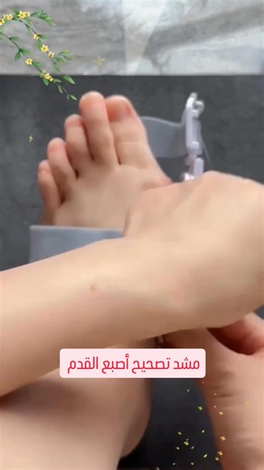 تخلص من آلام تشوه أصبع القدم بطريقة مريحة وآمنة. مصحح أصبع القدم الطبي – الحل الأمثل للمشي براحة. تصميم مرن وخفيف يناسب الاستخدام اليومي حتى مع الأحذية. يساعد على تصحيح الانحراف وتخفيف الضغط على الأصابع. | SmartDeals6