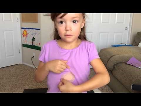 Update: Using Eye Patch to Correct Lazy Eye & Improve Vision