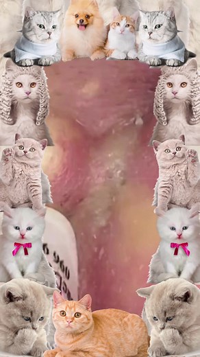 Skin cleansing & Pedicure #fyp #foryou #fypシ #pimple #satisfyingvideo #viral #skincare #skincare #ingrowntoenail #pedicure