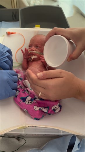 𝒄𝒖𝒕𝒆𝒍𝒊𝒕𝒕𝒍𝒆𝒃𝒂𝒃𝒊𝒆𝒔𝒗𝒊𝒓𝒂𝒍™ on Instagram: "Micro preemie first bath with CPAP belly 😍❤️ Credits: @emily_dethloff . . . . . . . . . . . . . . . . . . . . . . . . . . . . . . . . . . . . . . . . . . . . . . . . . . . . . . . . . . . . . . . . . . . . . . . . . . . . . . . . . . . . . . #love #cute #micropreemie #baby #viral"