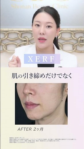 [Super Hot Topic] Have you heard of XERF? The latest RF treatment from Korea that will give you b...