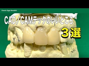 【歯科技工士】テック（テンポラリークラウン・仮歯）を歯科用CAD／CAMで作るメリット3選【exocad3.0】