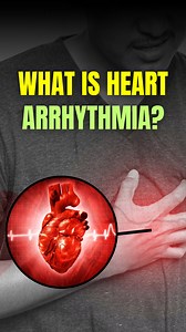 What is Heart Arrhythmia ❓🫀 Heart arrhythmia, also known simply as arrhythmia, refers to an irregular or abnormal heartbeat. The heart's normal rhythm is controlled by a natural pacemaker called the sinoatrial (SA) node, which produces electrical impulses that regulate the heart rate. However, in the case of arrhythmia, the heart's electrical impulses may occur too quickly, too slowly, or irregularly, disrupting the normal rhythm. Arrhythmias can affect either the atria (upper chambers) or the 