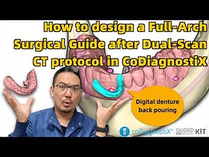 How to Design a Full-Arch Surgical Guide After Dual-Scan CT Protocol in CoDiagnostiX DAS Guided Kit
