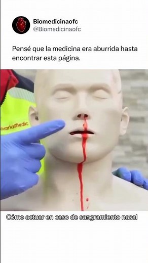 ⚠️ ¿SANGRE POR LA NARIZ? CÓMO DETENERLA EN 10 MINUTOS SIN RIESGOS 🧠