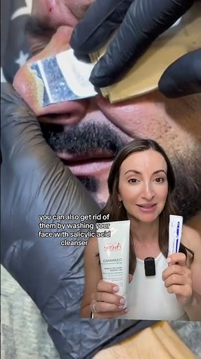 SHOCKING Intense Nose Extraction: Sebaceous Filaments Removal Reaction Video 😳 #skincare