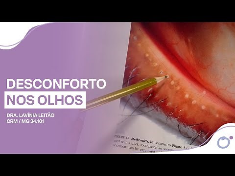 Glândulas de Meibomius. Dra. Lavínia Leitão