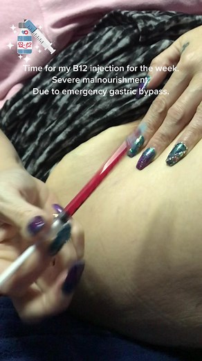 My weekly b12 injection for severe malnourishment due to emergency gastric bypass. Eat your vitamins, or you'll end up injecting them. B12 anemia can lead to neurological damage and other health issues #fyp #selfcareroutine #medical #injection #shot #b12 #b12deficiency #b12injections #vitamins #malnutrition #gastricbypass #health #takecareofself #viewersdiscretionadvised #warning #triggerwarning #strength #selfreliance #awareness