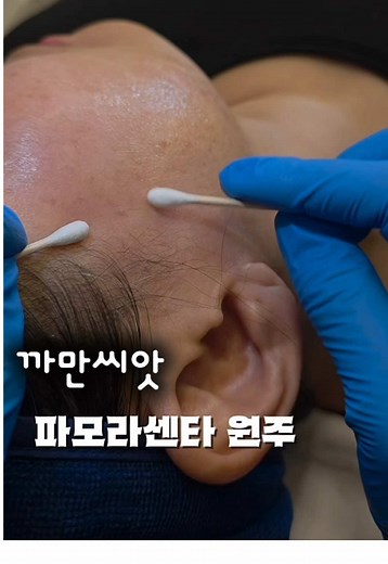 레이저 후 피부 관리: 홈케어 흐름의 중요성