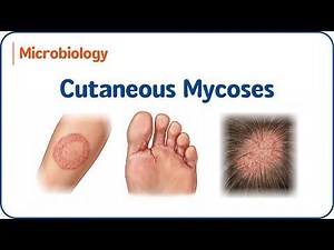 6. Cutaneous Mycoses | Superficial & Cutaneous Fungal Infections | USMLE Step 1 🧬